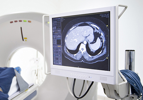 為什么IPS顯示技術(shù)應(yīng)用于診斷顯示器?